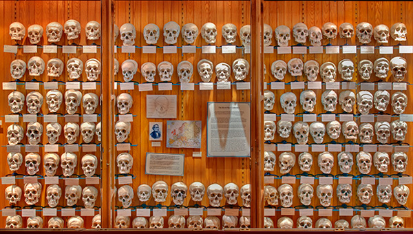 The Hyrtl skull collection.